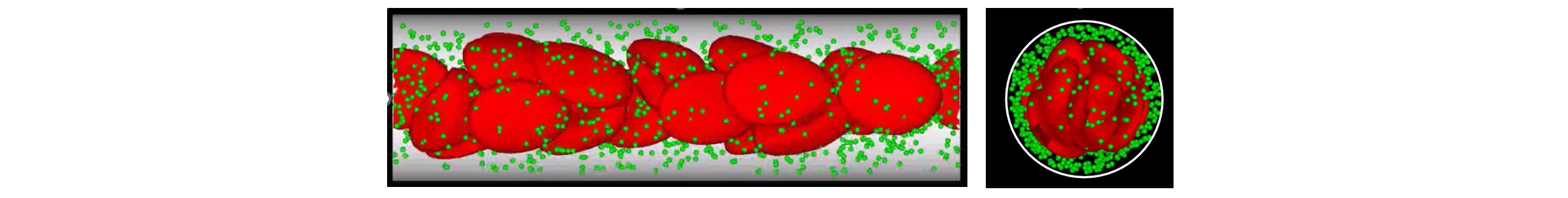 人工赤血球投与による血管腫へのレーザー治療効果