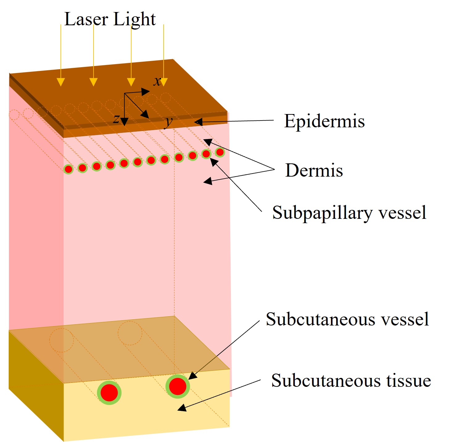 人工赤血球投与による血管腫へのレーザー治療効果